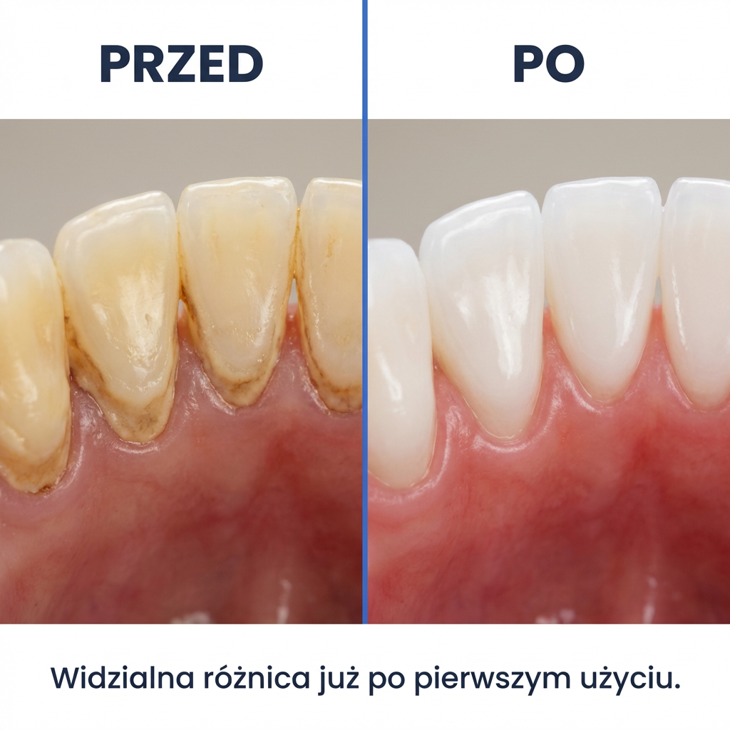Elektryczny Skaler Ultradźwiękowy do Usuwania Kamienia | DENTICLEAN