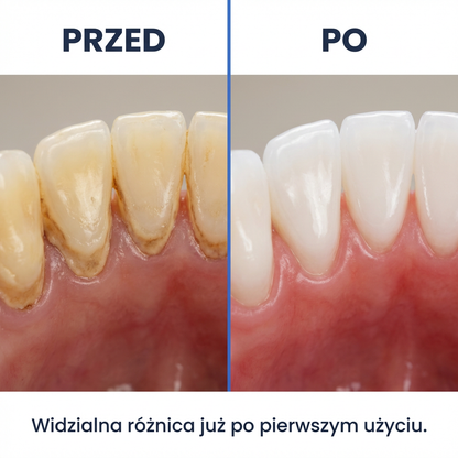 Elektryczny Skaler Ultradźwiękowy do Usuwania Kamienia | DENTICLEAN